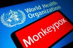 NÓNG: WHO tuyên bố đậu mùa khỉ là tình trạng khẩn cấp y tế toàn cầu