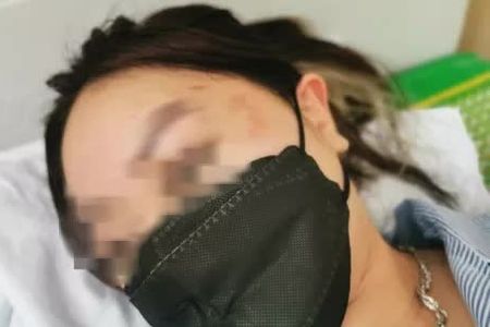 Cô gái trẻ tố bị người đàn ông sàm sỡ, hành hung đến nỗi phải nhập viện